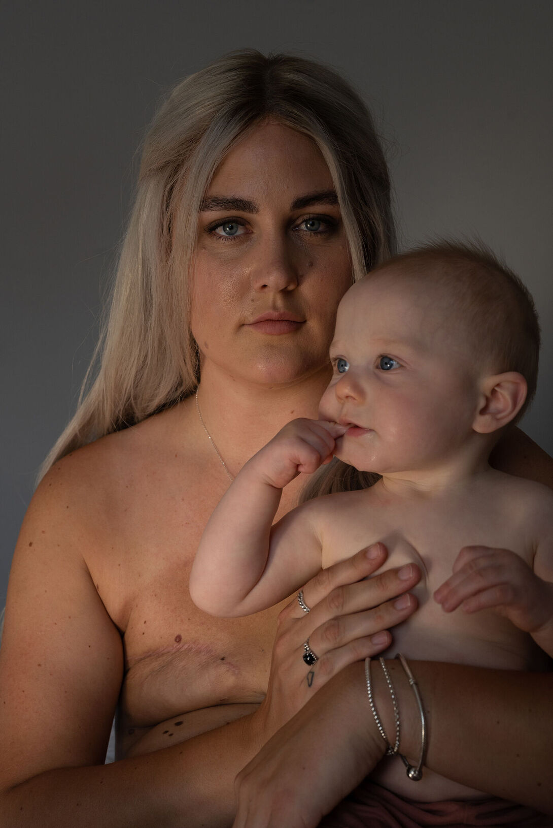 Stella McCartney post double mastectomy bra Louise Listening